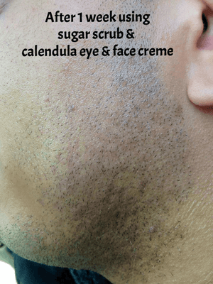 Calendula Eye & Face Crème - Nourishing Skin Care Delight for Dry Skin